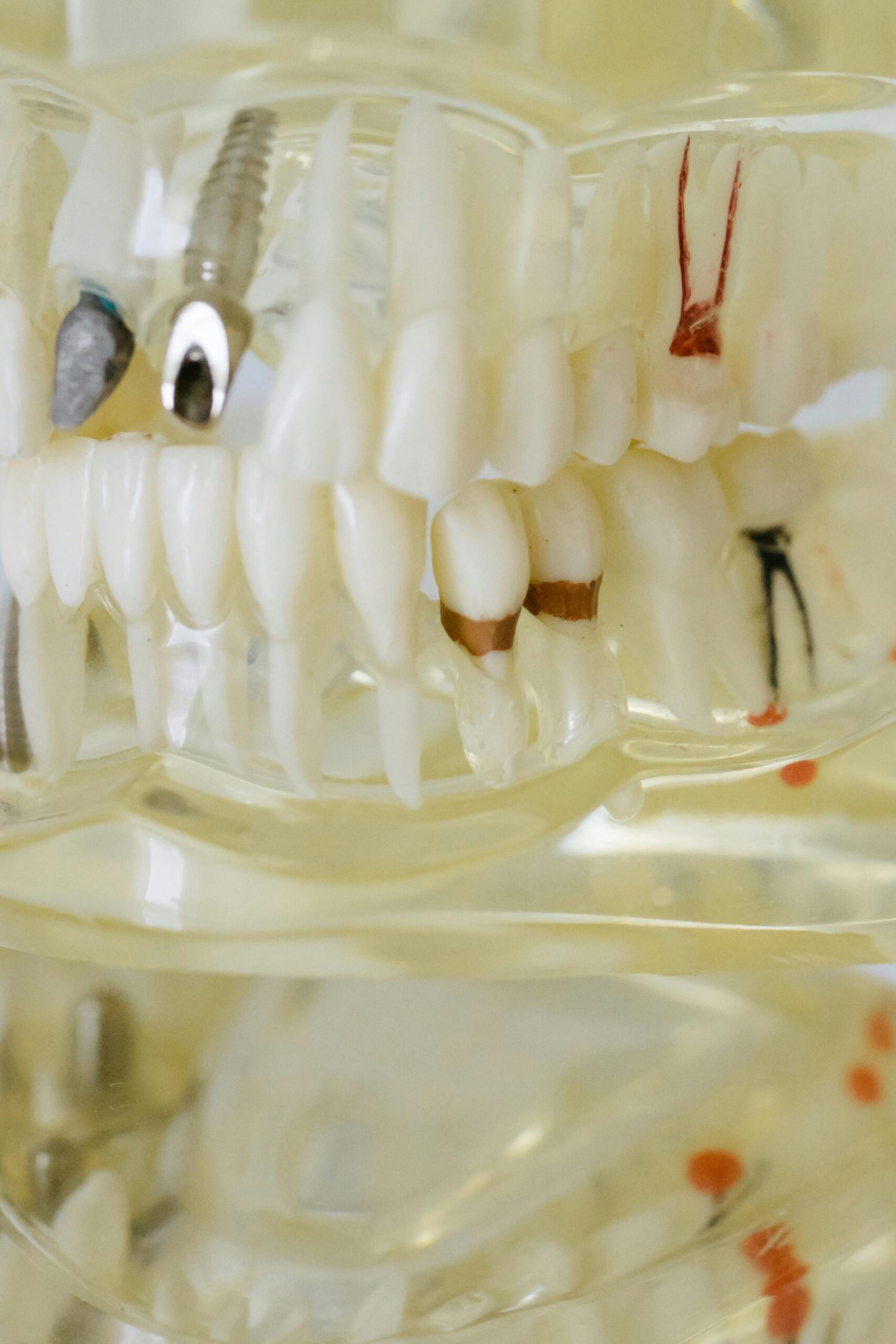 implant1-3